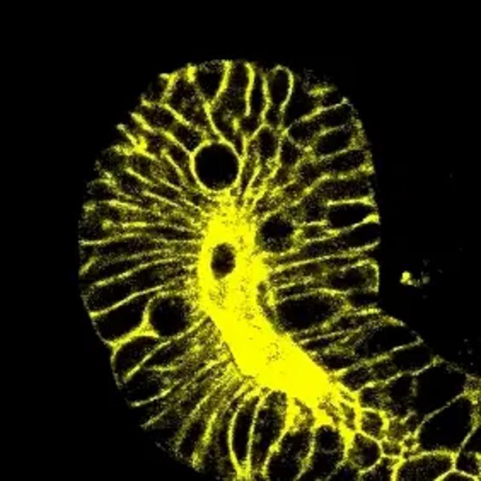 Cell division in action