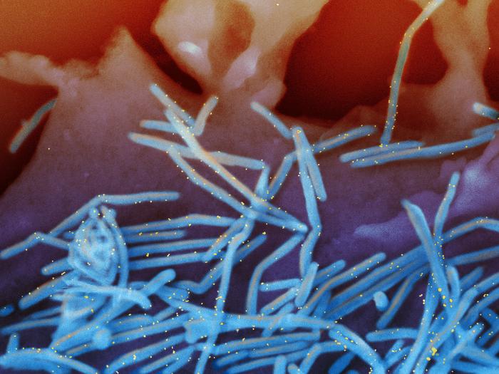 Human respiratory syncytial virus