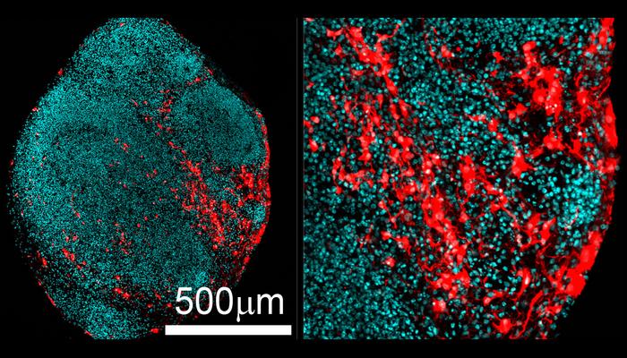 Mutated cells in human brain organoids