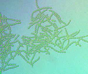 Filamentous cyanobacteria  (Nostoc punctiforme)