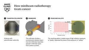 How minibeam radiotherapy treats cancer