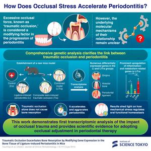 How Does Occlusal Stress Accelerate Periodontitis?