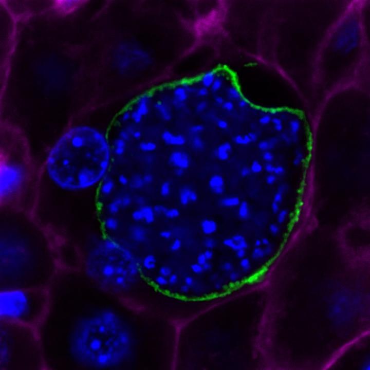 <i>P. berghei </i>Parasite Multiplies Inside a Liver Cell