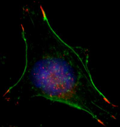 Breast Cancer Cell in Normal Oxygen