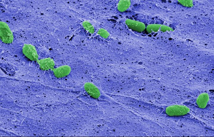 <em>Pseudomonas aeruginosa</em> Biofilm -- False Color