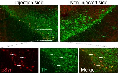 Misfolded Proteins Cause Parkinson's-Like Condition in Mice (2 of 3)