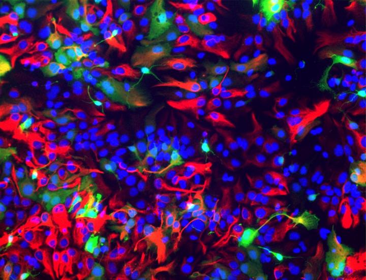 From Neurostem Cells to Astrocytes