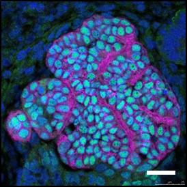 Reconstituted Glomeruli