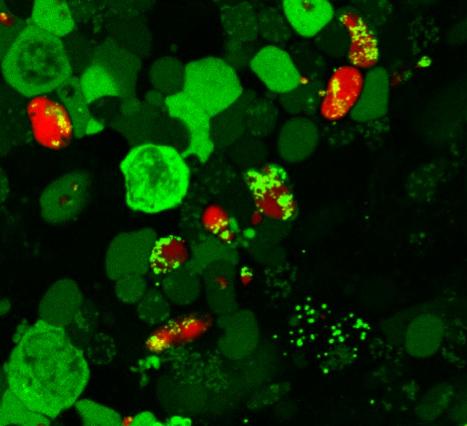 Plasmodium Gametocytes Display Homing and Vascular Transmigration in the Host Bone Marrow (3 of 3)