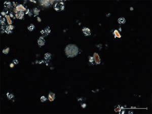 Calcareous nannofossils from the SW Pacific Ocean show that plankton turnover occurred before the PETM. Image: MARUM – Center for Marine Environmental Sciences, University of Bremen; H. Jones.