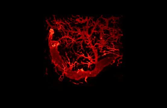 Pancreatic Duct Network