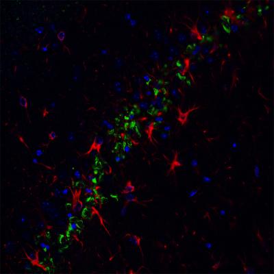 Beta-Amyloid