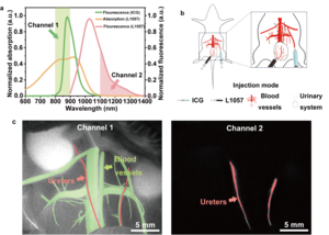 Multi-mode imaging of urinary system and blood vessels under the excitation of a single 915 nm CW laser