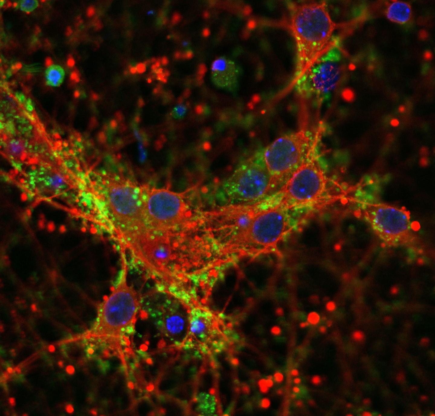 Protein Deposits α-synuclein