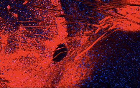 Dynorphin Neurons