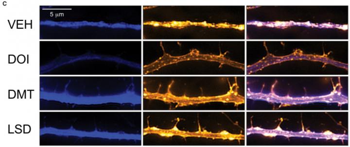 Psychedelics on Cortical Neurons