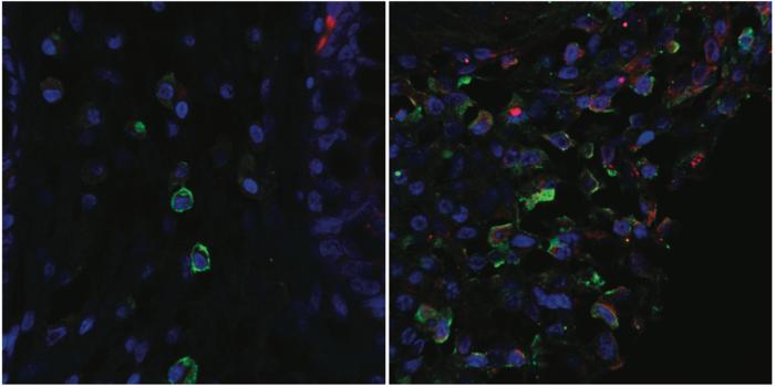 Microscopy images comparing 'quiet' gut tissue (left) and inflamed tissue (right)