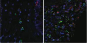 Microscopy images comparing 'quiet' gut tissue (left) and inflamed tissue (right)