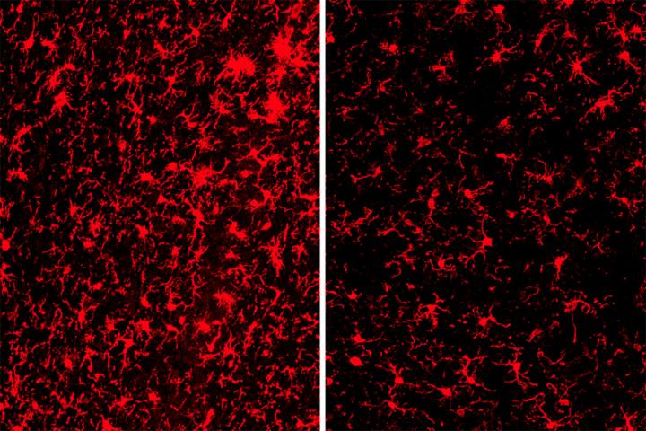Alzheimer's Gene Poses both Risk -- and Benefits