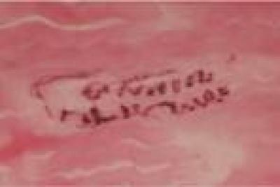 Immunohistochemical Staining