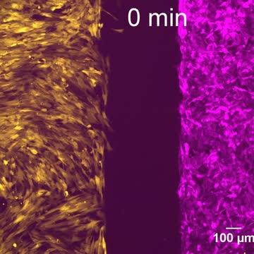 <i>PNAS</i> p53 Aids Cancer Cell Migration