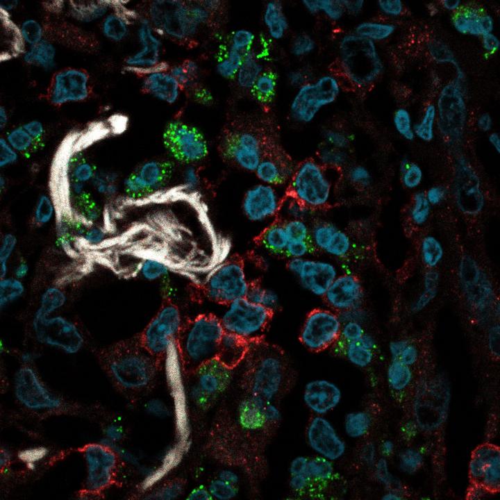 T Cells