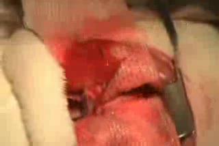 Transplantation of Engineered Rat Lung
