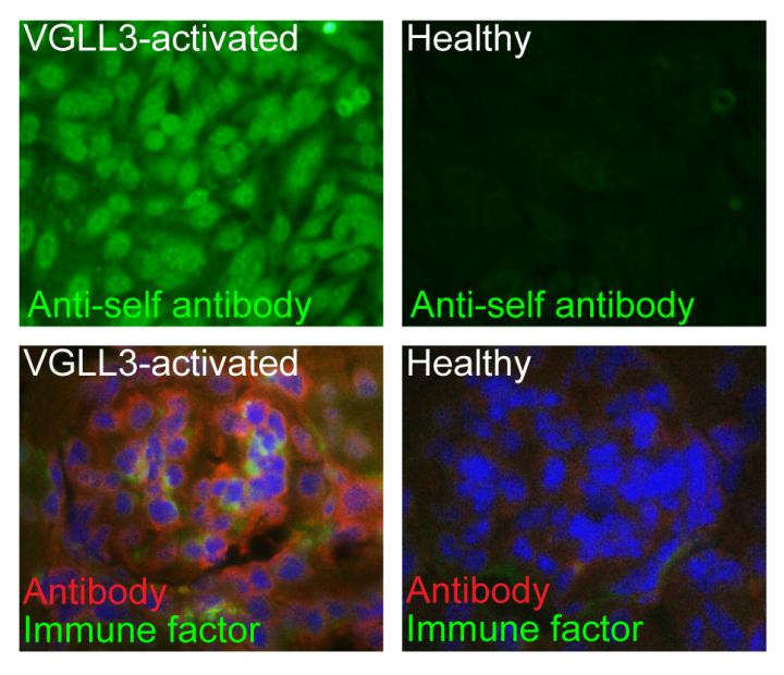 VGLL3 and Autoimmune