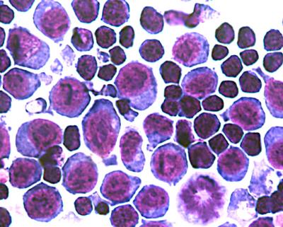 Erythroblasts