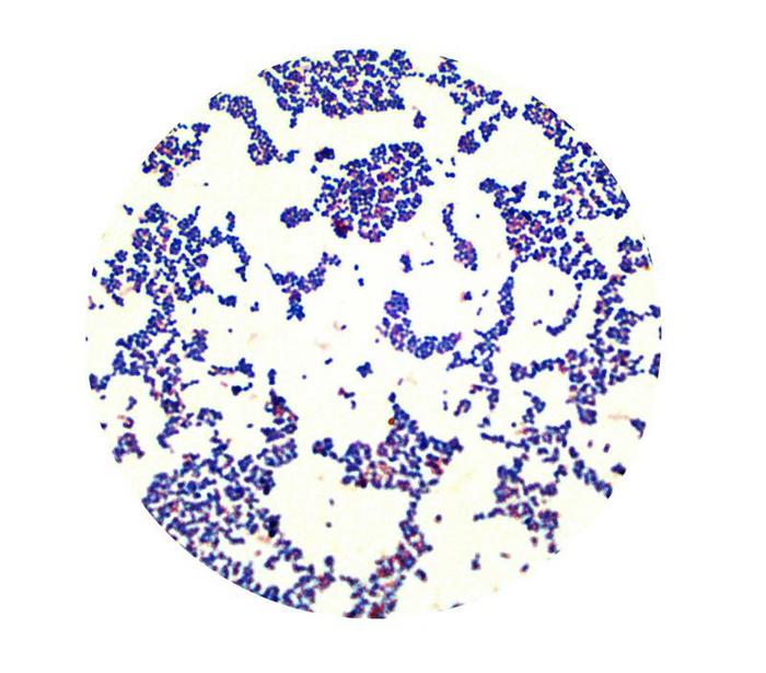 Novel bacterium