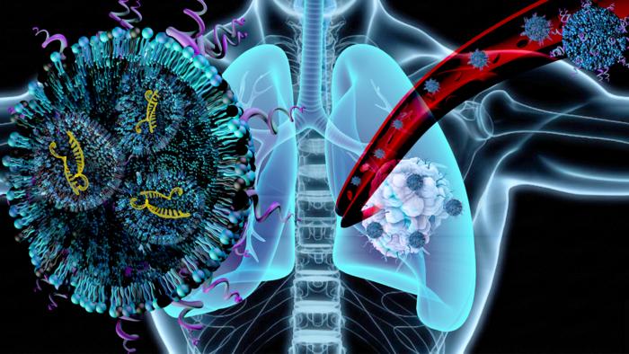 Lung cancer and LNPs