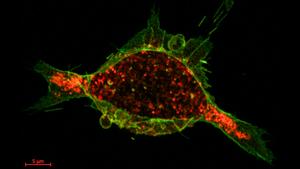 Cancer cell under treatment