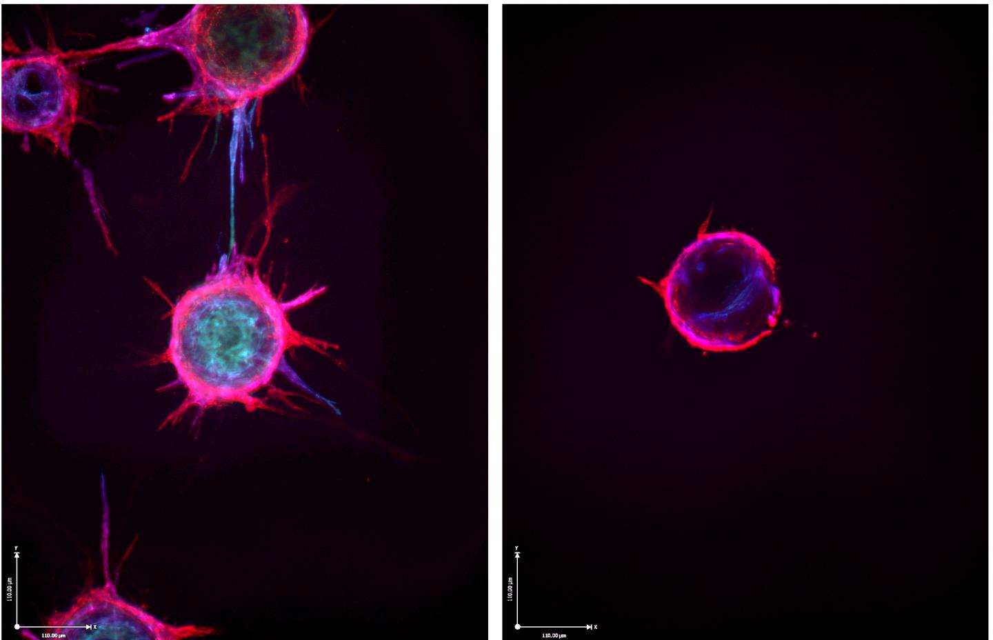 Here's How Cancer Hijacks Wound Healing to Create Its Own Blood Supply