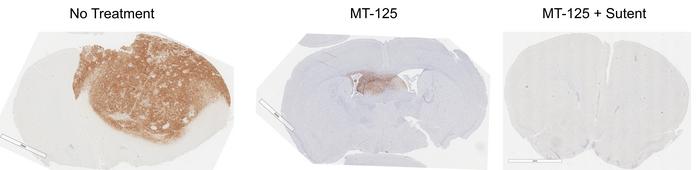 MT-125 and Sutent synergize to attack brain tumors