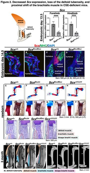 Decreased Scx expression, loss of the deltoid tuberosity, and proximal shift of the brachialis muscle in CSE-deficient mice