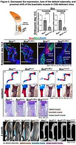 Decreased Scx expression, loss of the deltoid tuberosity, and proximal shift of the brachialis muscle in CSE-deficient mice
