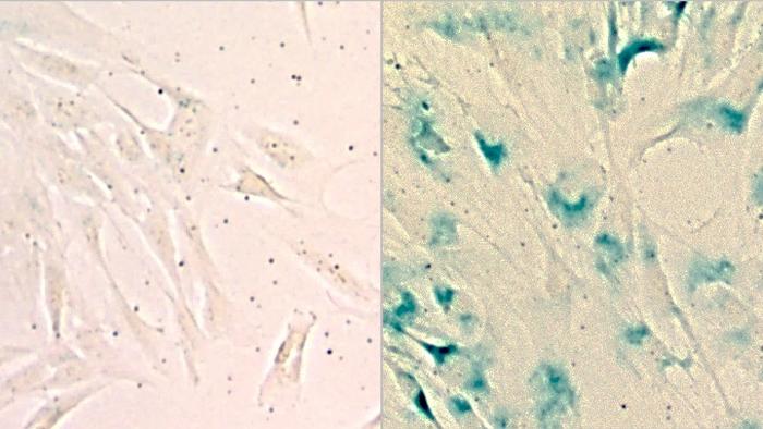 Healthy versus senescent lung cells