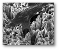 Osteoblast in Action