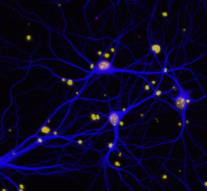 Breaking Down BRCA1
