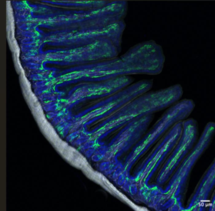 The Hidden Cells That Keep the Intestine Healthy