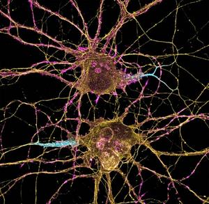 Neuroimmune crosstalk across tissues mediated by group 2 innate lymphoid cells (ILC2s)