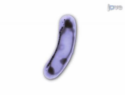 Magnetotactic Bacteria