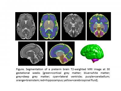 Segmentation