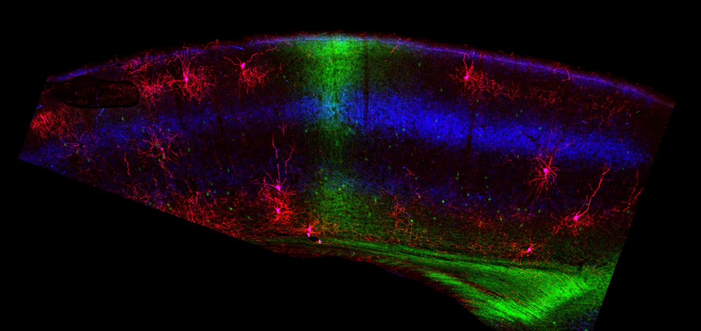 Binocular Vision Region of the Visual Cortex