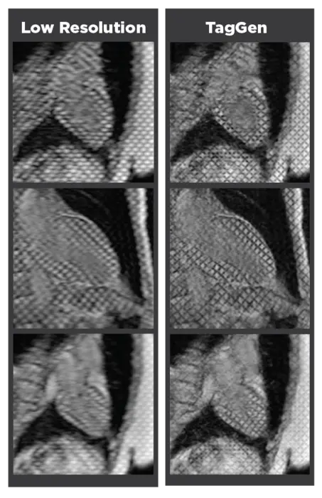 Heart MRI Scan Comparisons