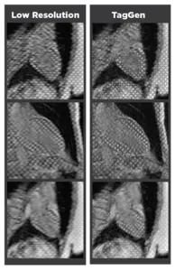 Heart MRI Scan Comparisons