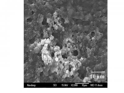 Fighting Listeria and Other Food-Borne Illnesses With Nanobiotechnology