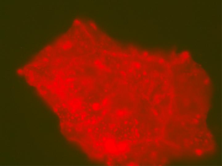 Microbes in Dinosaur Bone