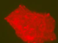 Microbes in Dinosaur Bone