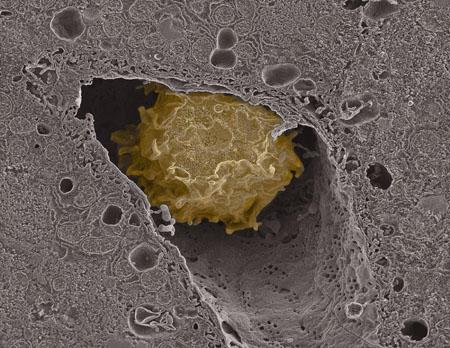 Macrophage